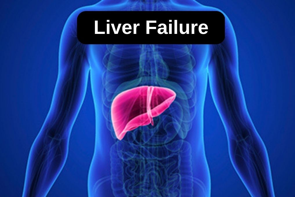 Best Liver Failure Treatment in Indore