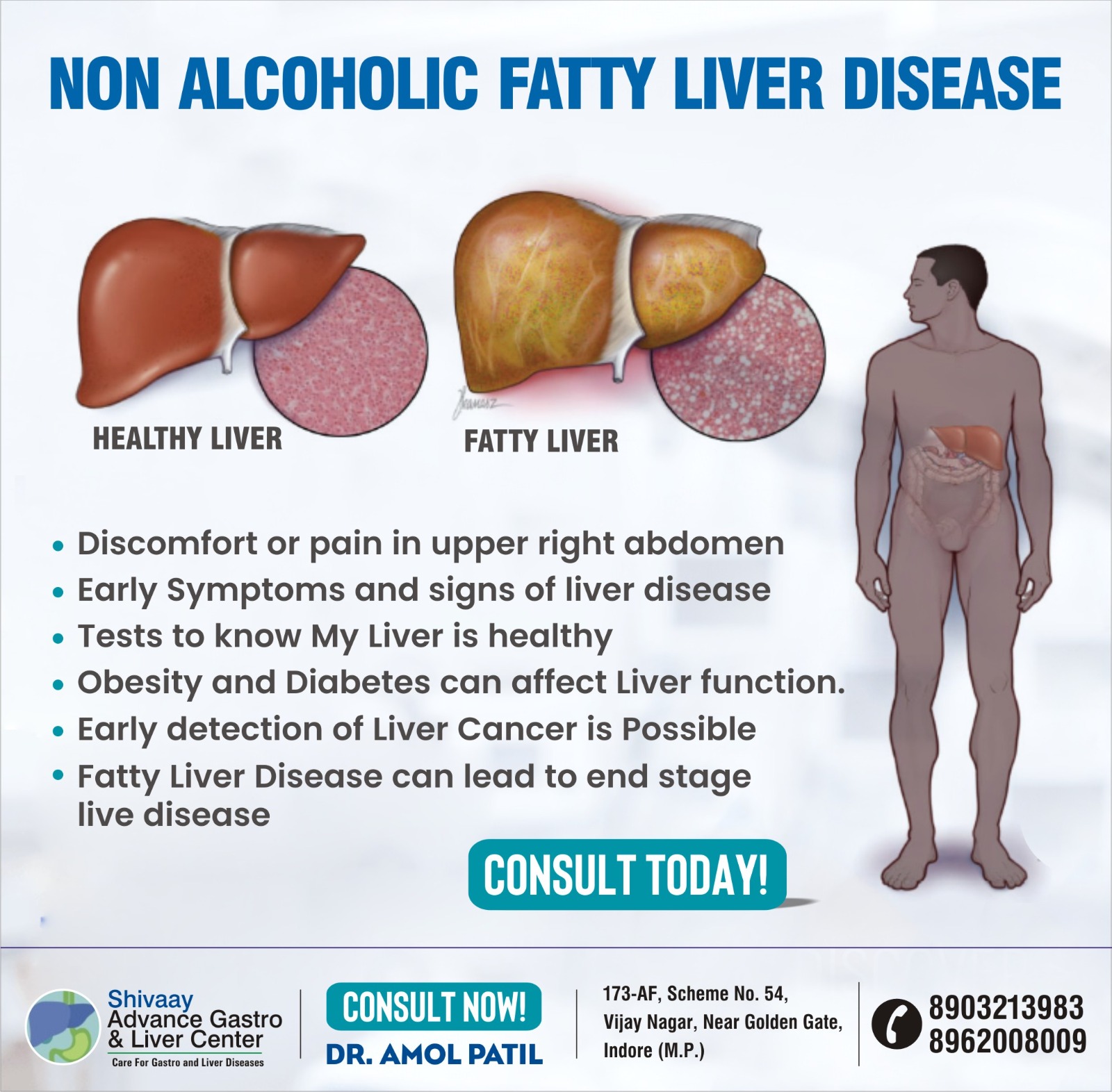 Best Liver Specialist in Indore