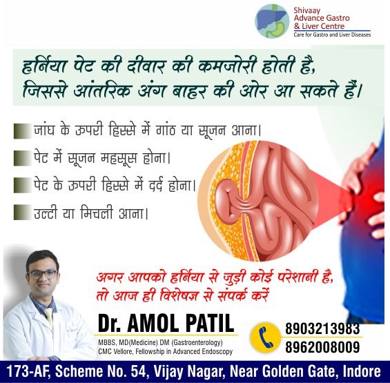 Best Doctor For Hernia Treatment In Indore