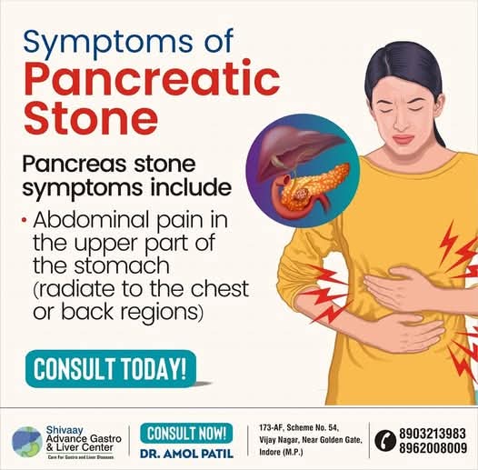 Best Pancreatic Stone Treatment in Indore