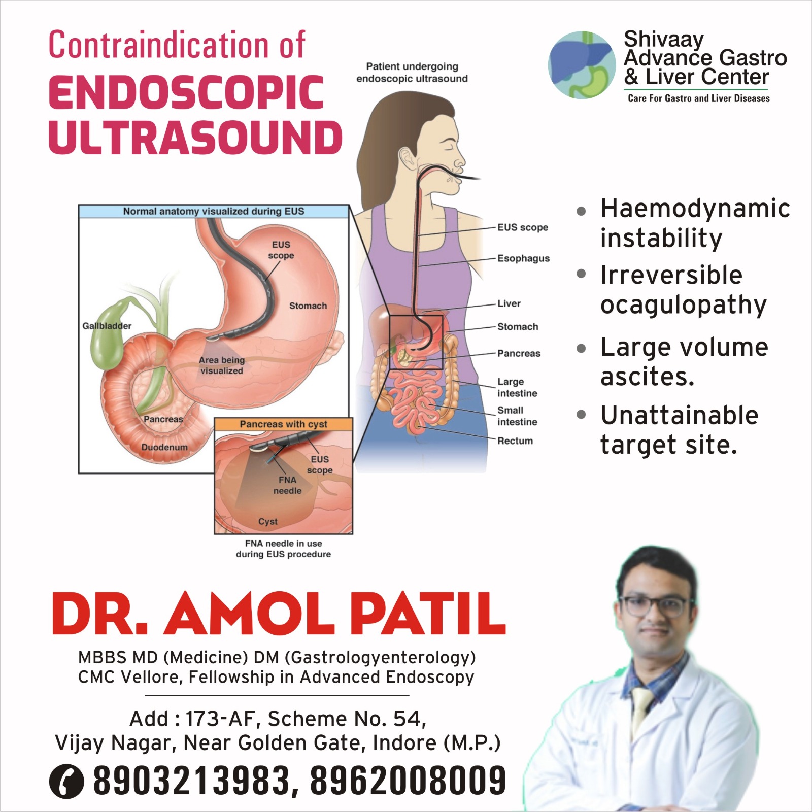 Best Doctor For Ulcer Treatment In Indore