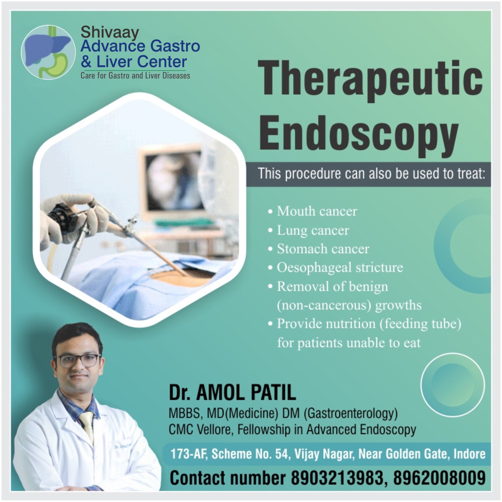 Therapeutic endoscopy in Indore