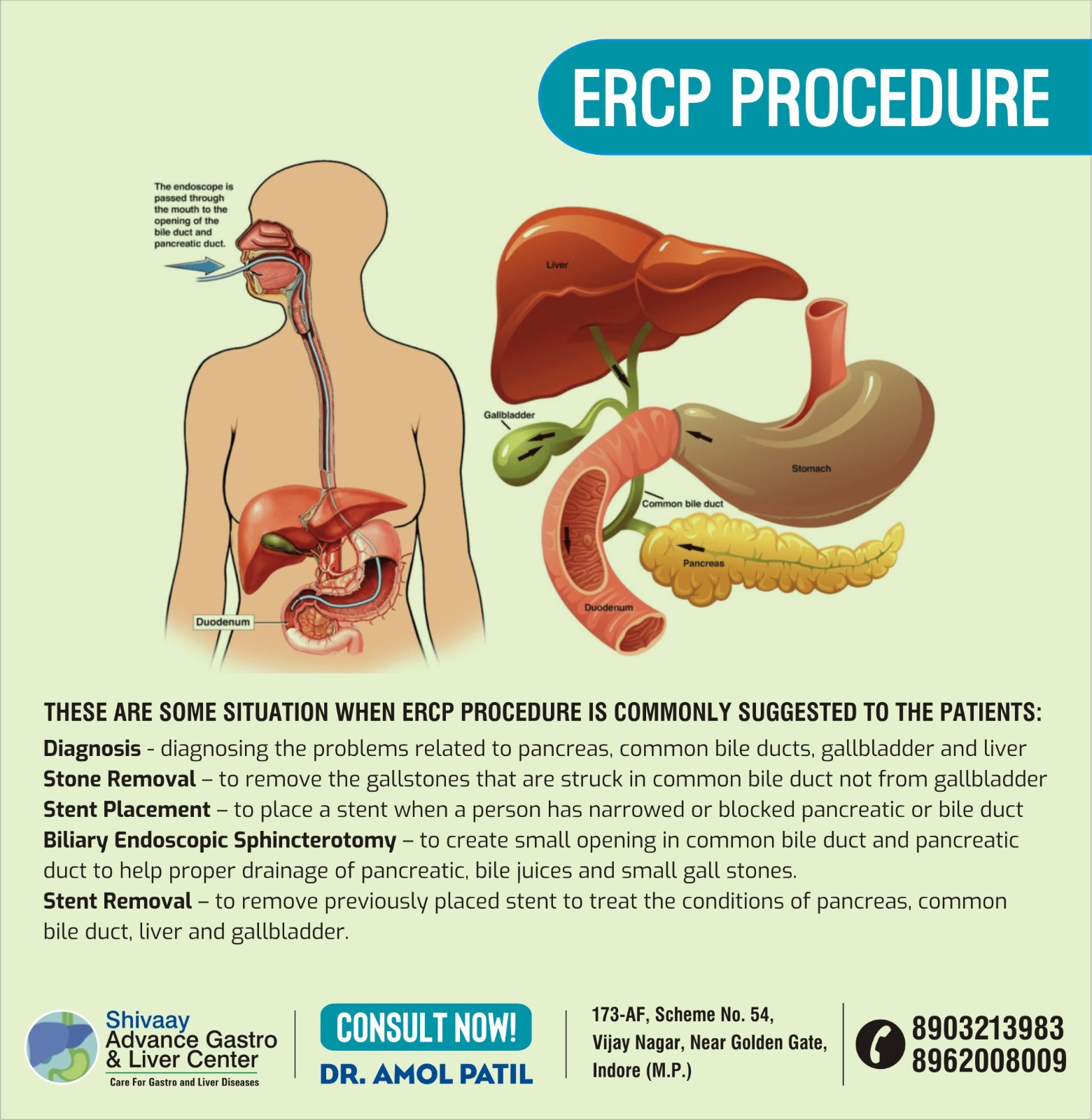 Best ERCP Procedure Specialist in Indore