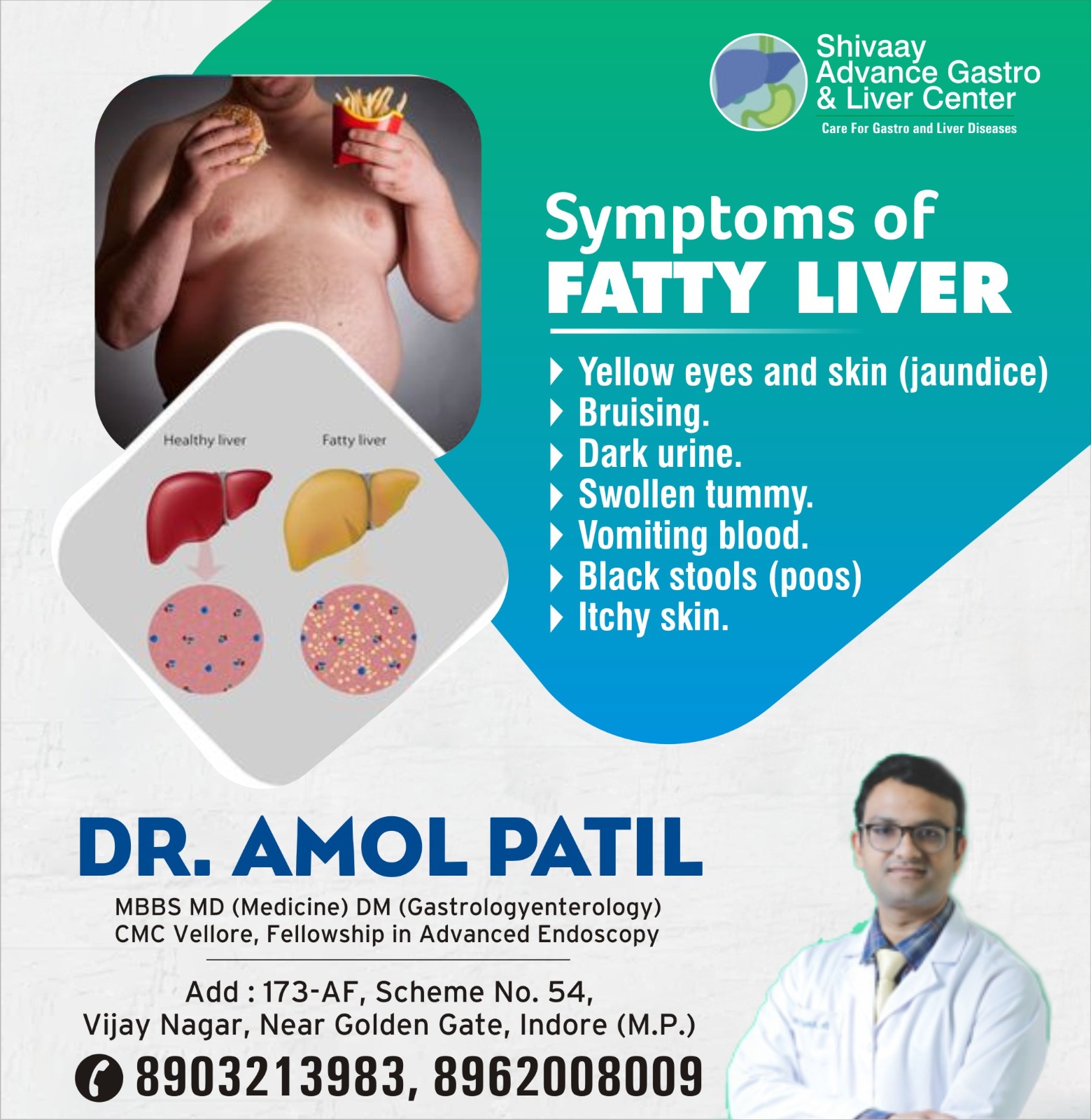 Doctor For Fatty Liver Treatment In Indore